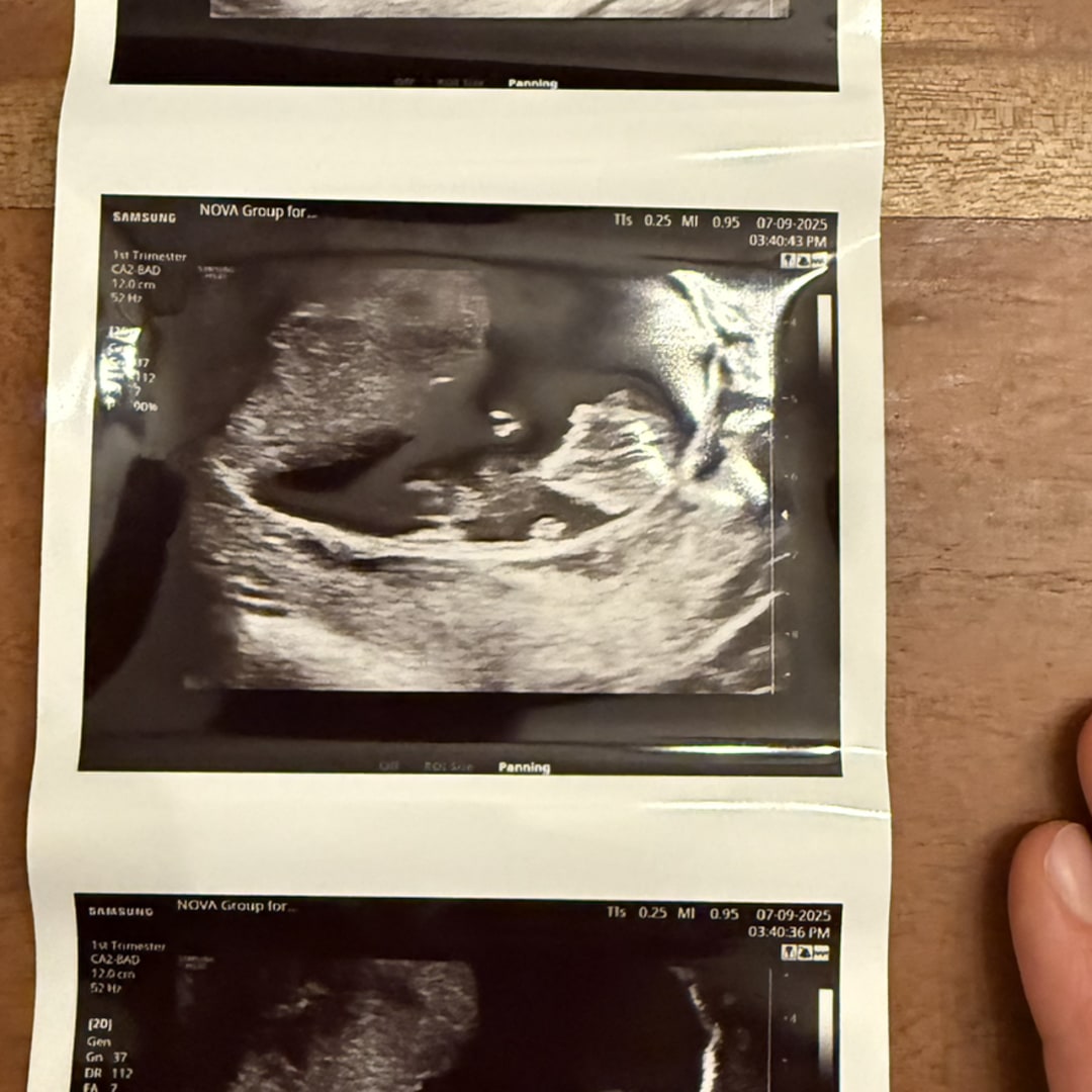 Photo shared by Maya for their Babylist baby registry.