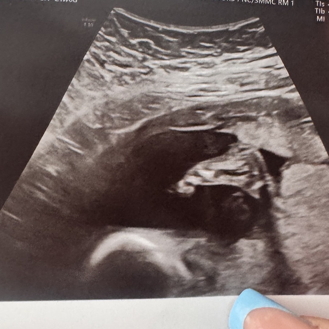 Photo shared by Harley for their Babylist baby registry.