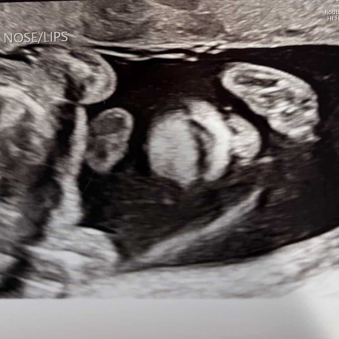 Photo shared by Annika for their Babylist baby registry.