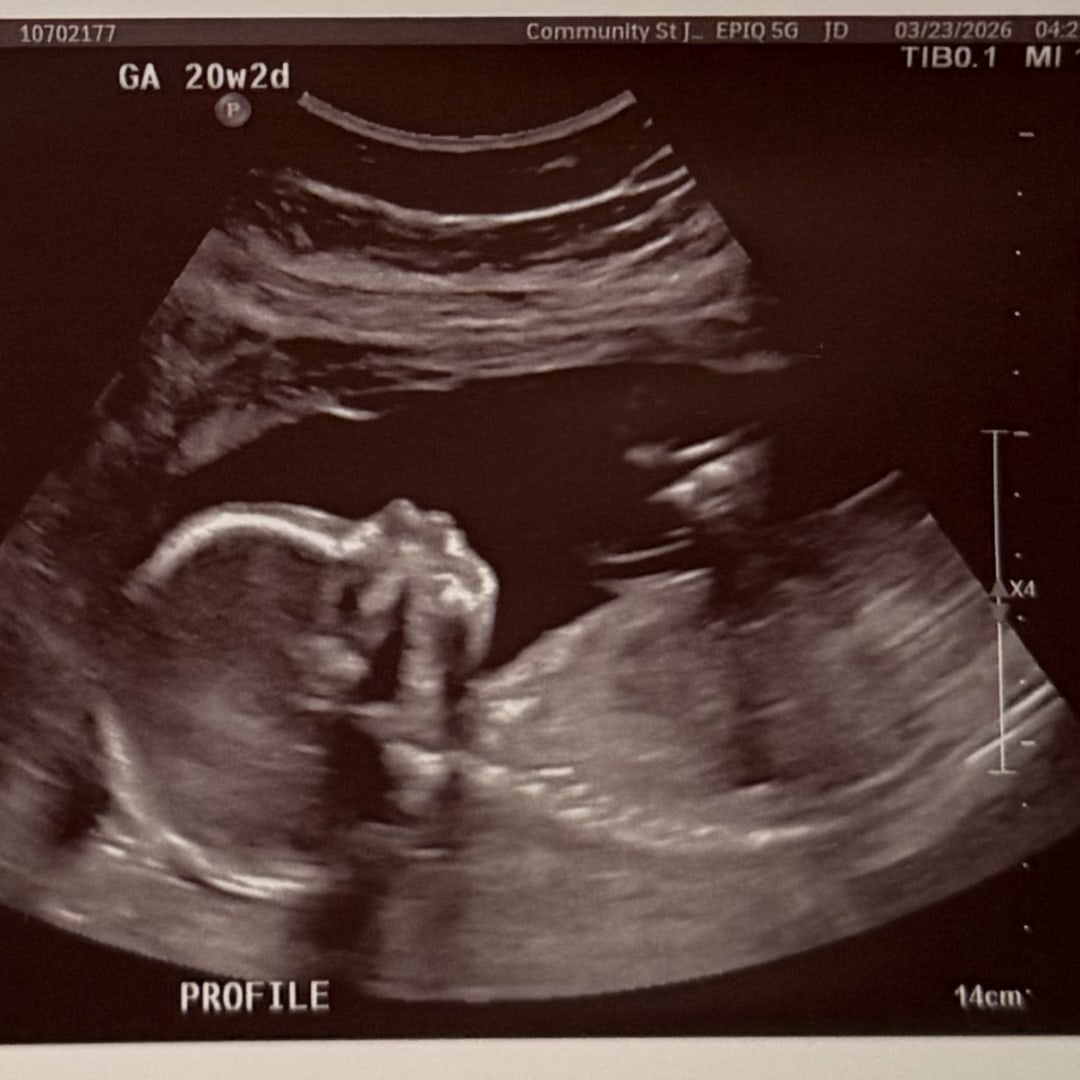 Photo shared by Kersten for their Babylist baby registry.