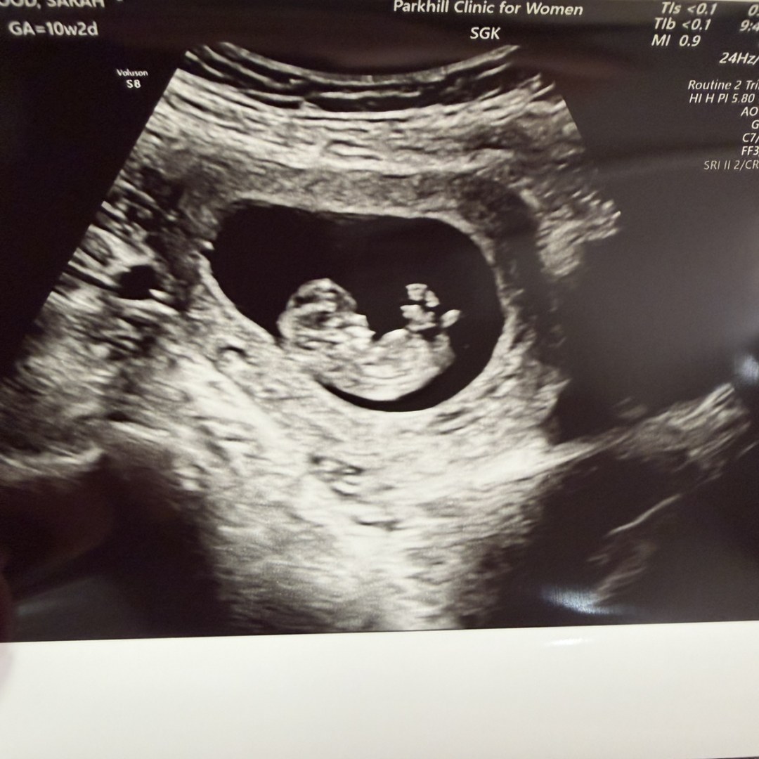 Photo shared by Sarah for their Babylist baby registry.