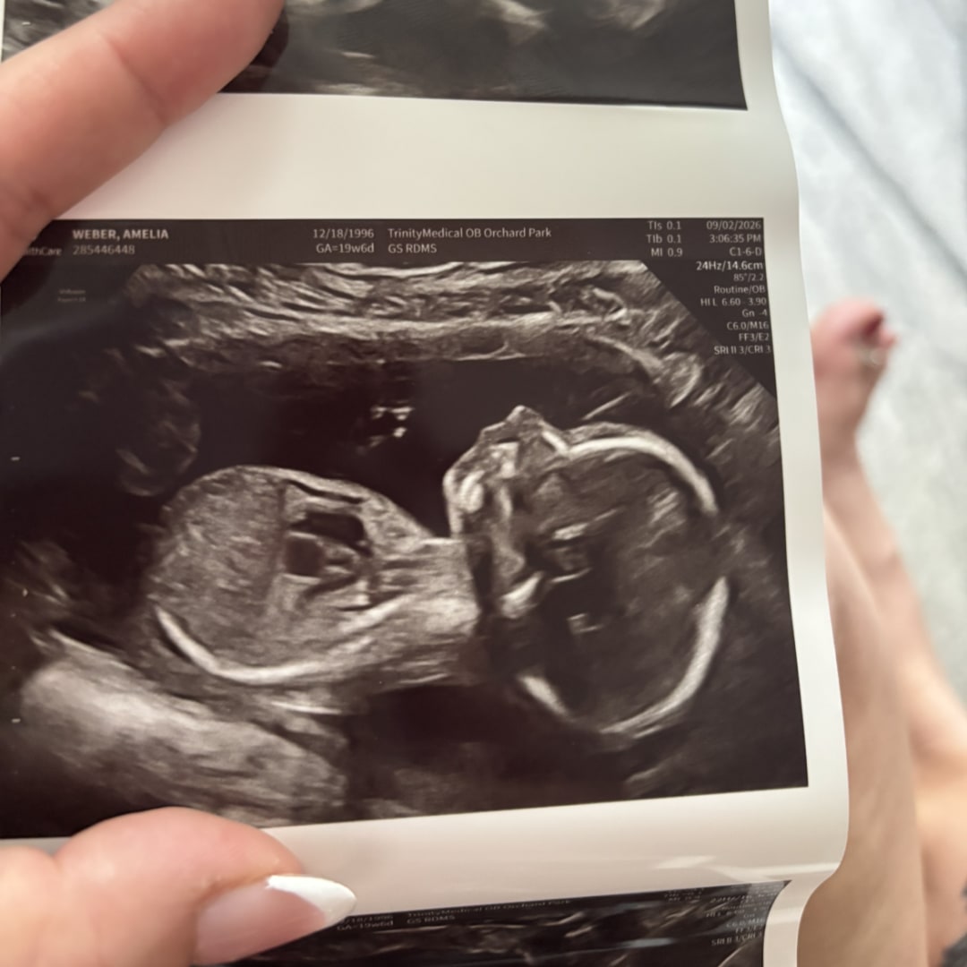 Photo shared by Amelia for their Babylist baby registry.