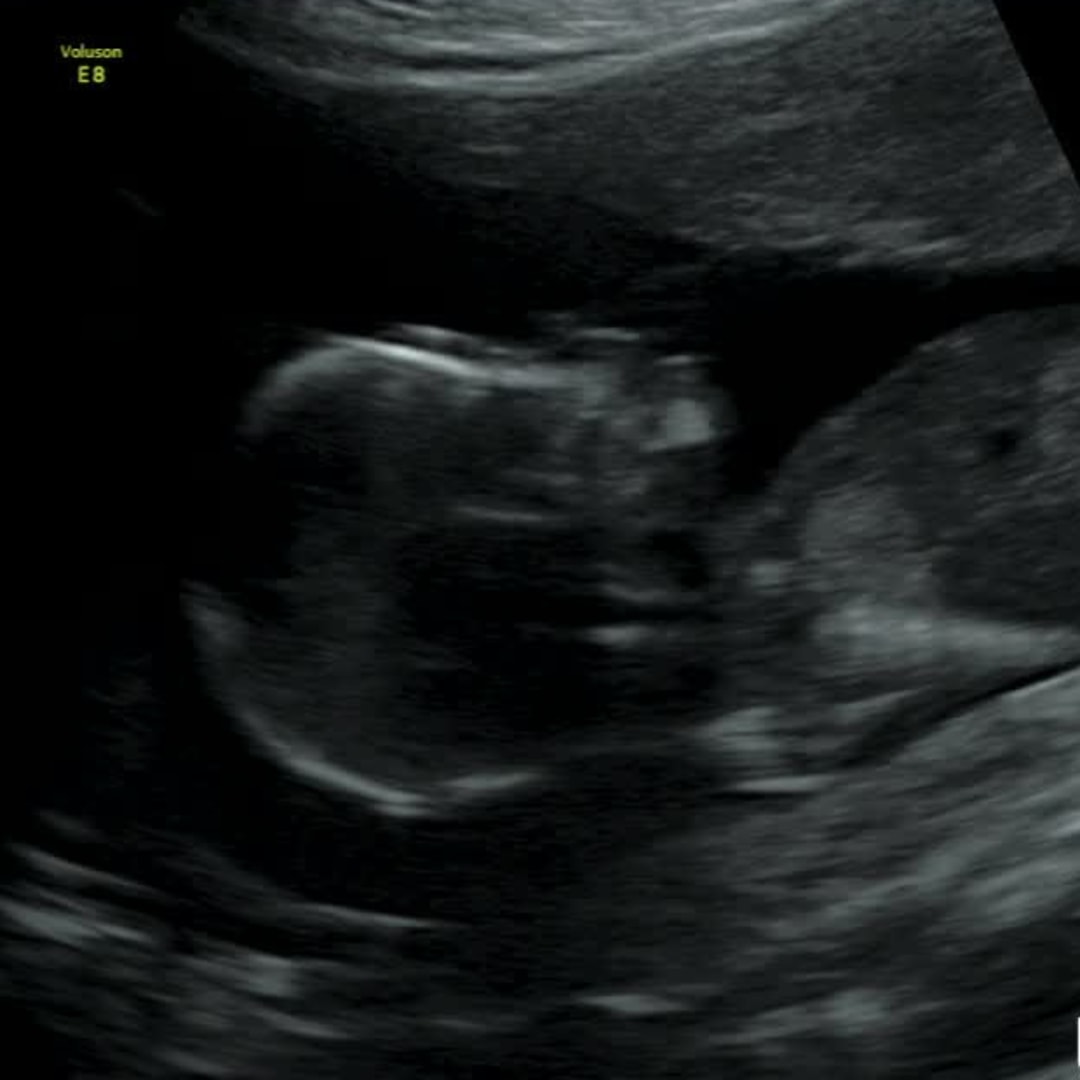 Photo shared by Jacqueline for their Babylist baby registry.