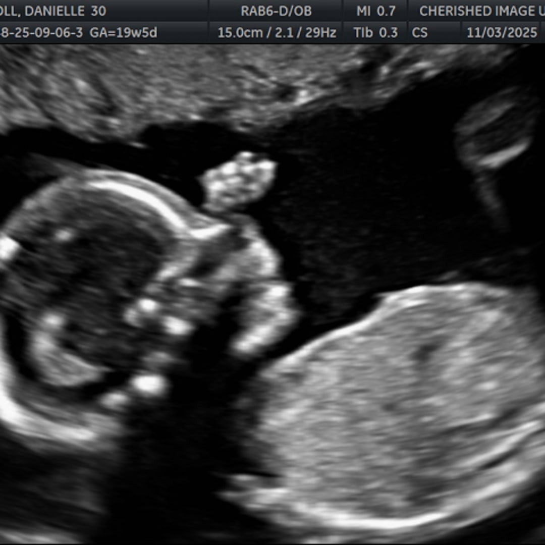 Photo shared by Danielle for their Babylist baby registry.