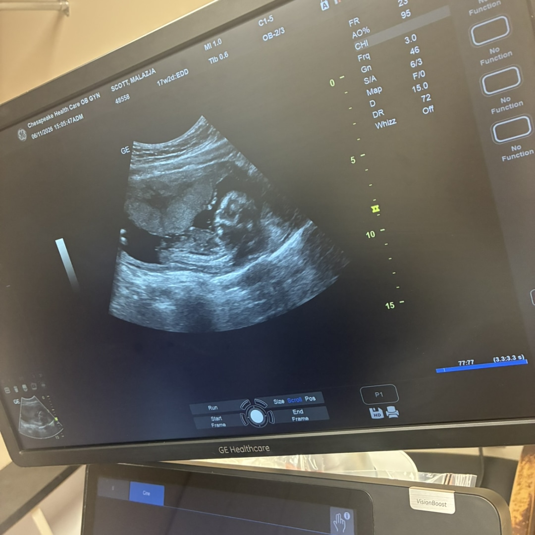 Photo shared by Malazja for their Babylist baby registry.