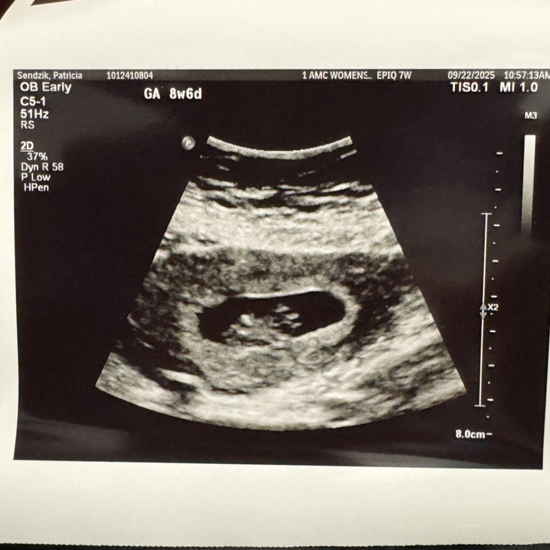 Photo shared by Patricia for their Babylist baby registry.