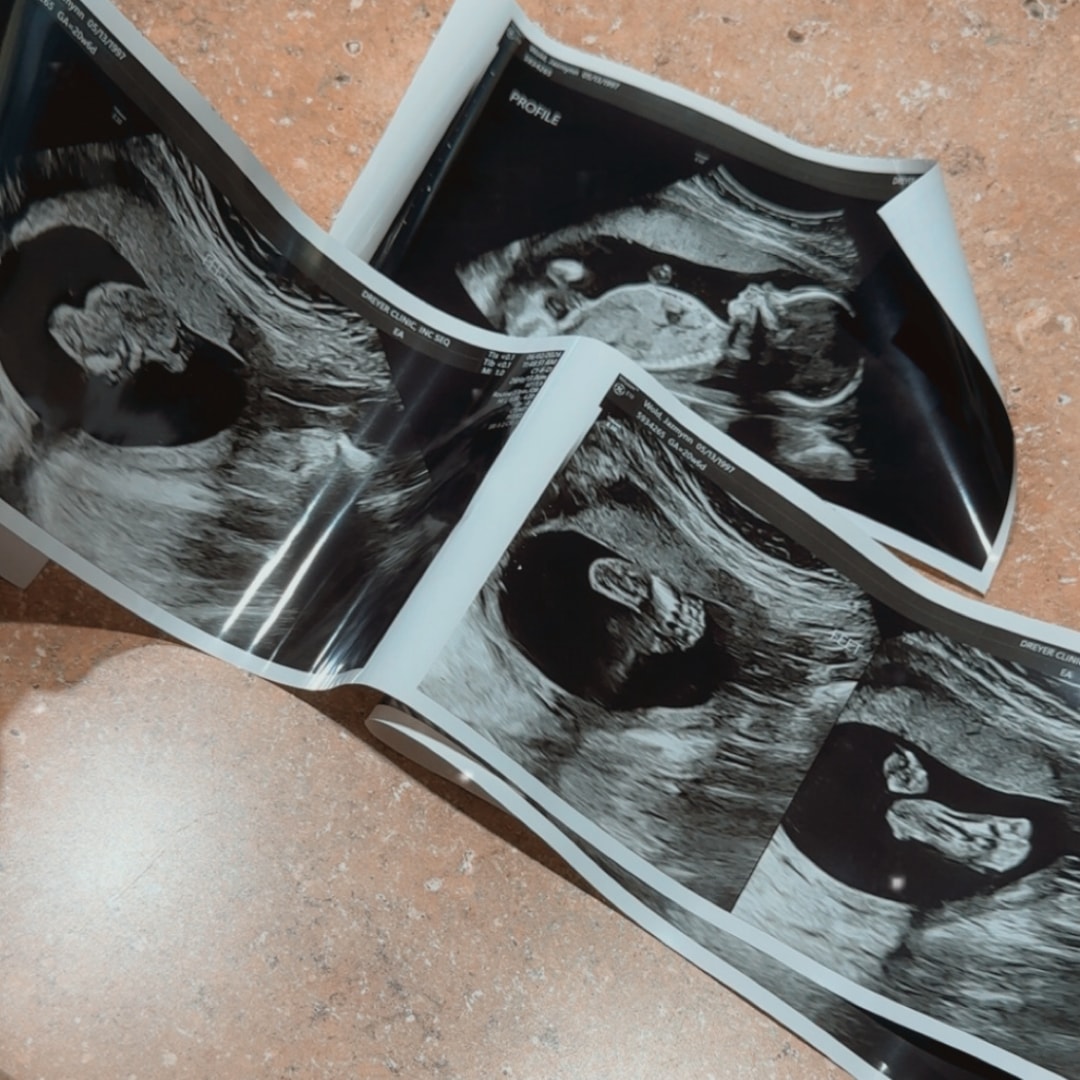 Photo shared by Jazmynn for their Babylist baby registry.