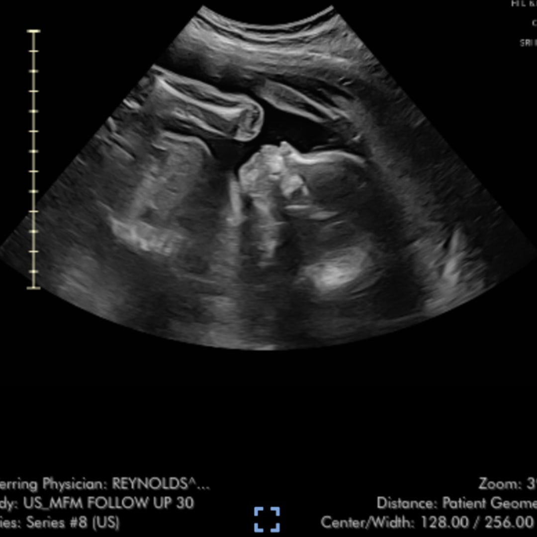 Photo shared by Miranda for their Babylist baby registry.