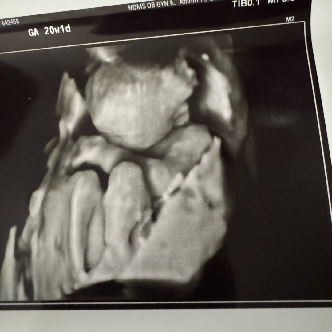 Photo shared by Celeste for their Babylist baby registry.