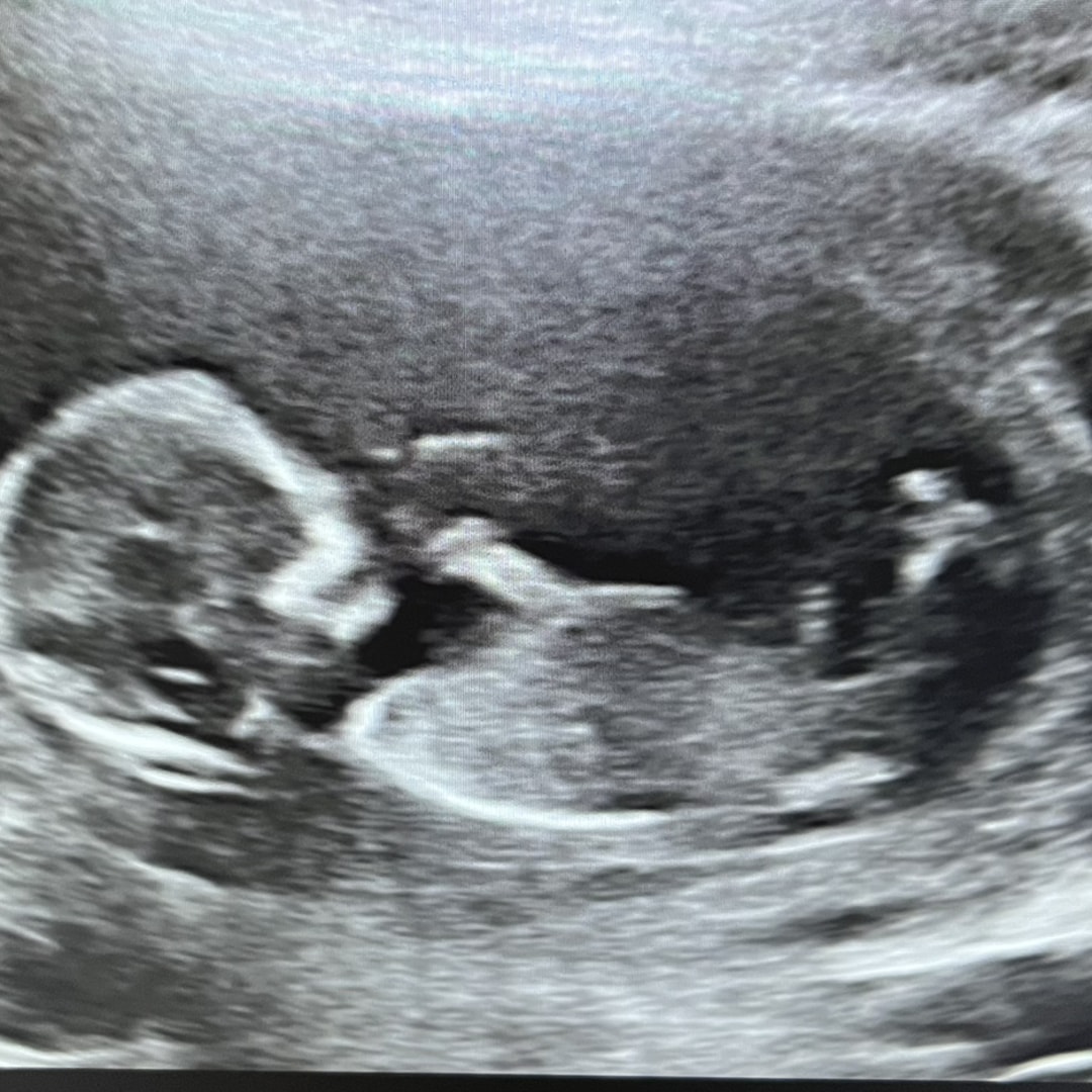 Photo shared by Victoria for their Babylist baby registry.