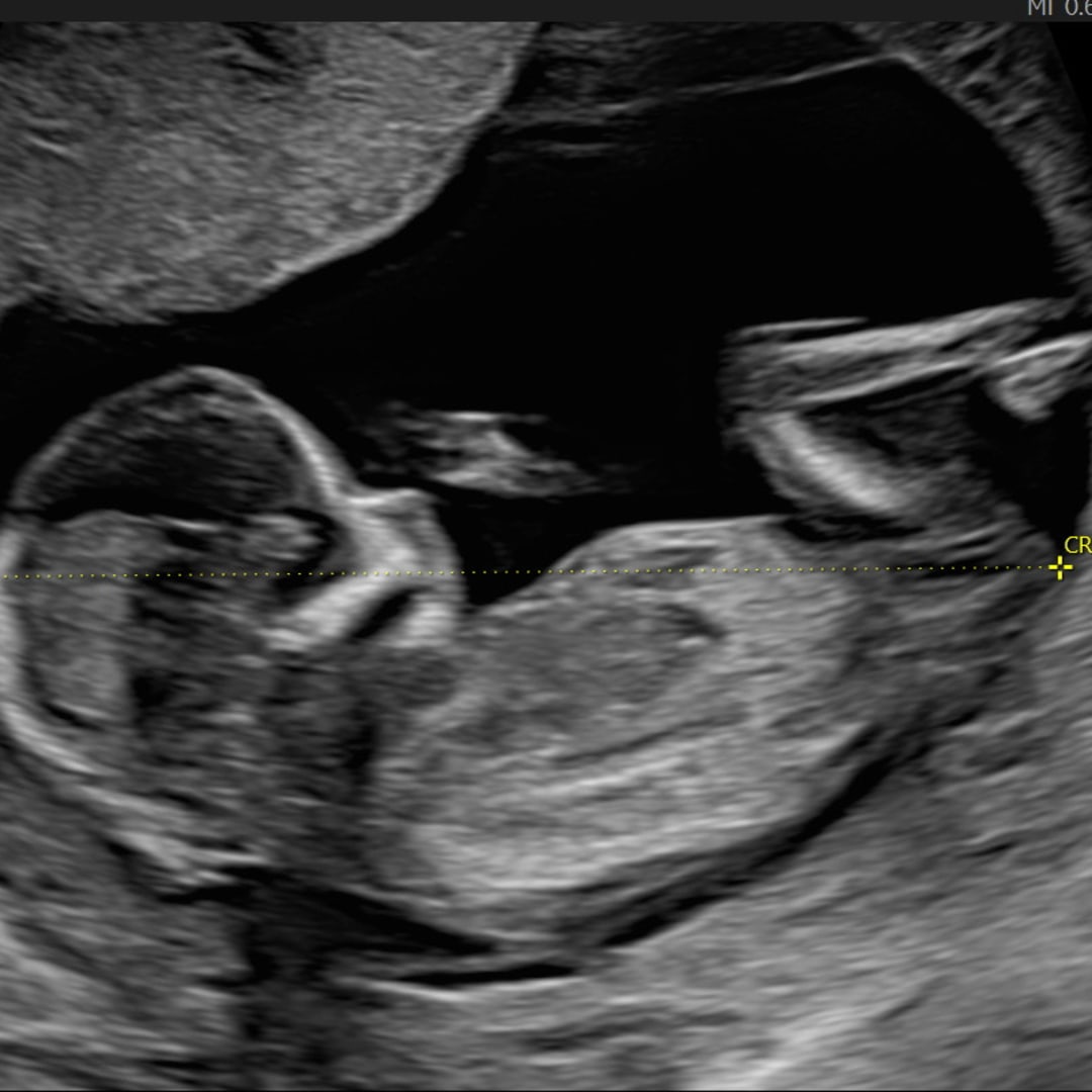 Photo shared by Allison for their Babylist baby registry.