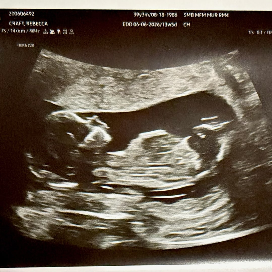 Photo shared by Rebecca for their Babylist baby registry.