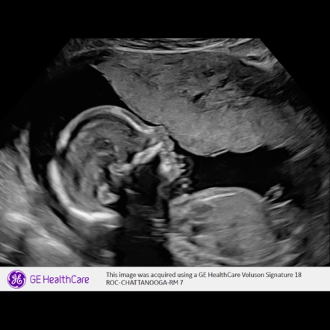 Photo shared by Lindsey for their Babylist baby registry.