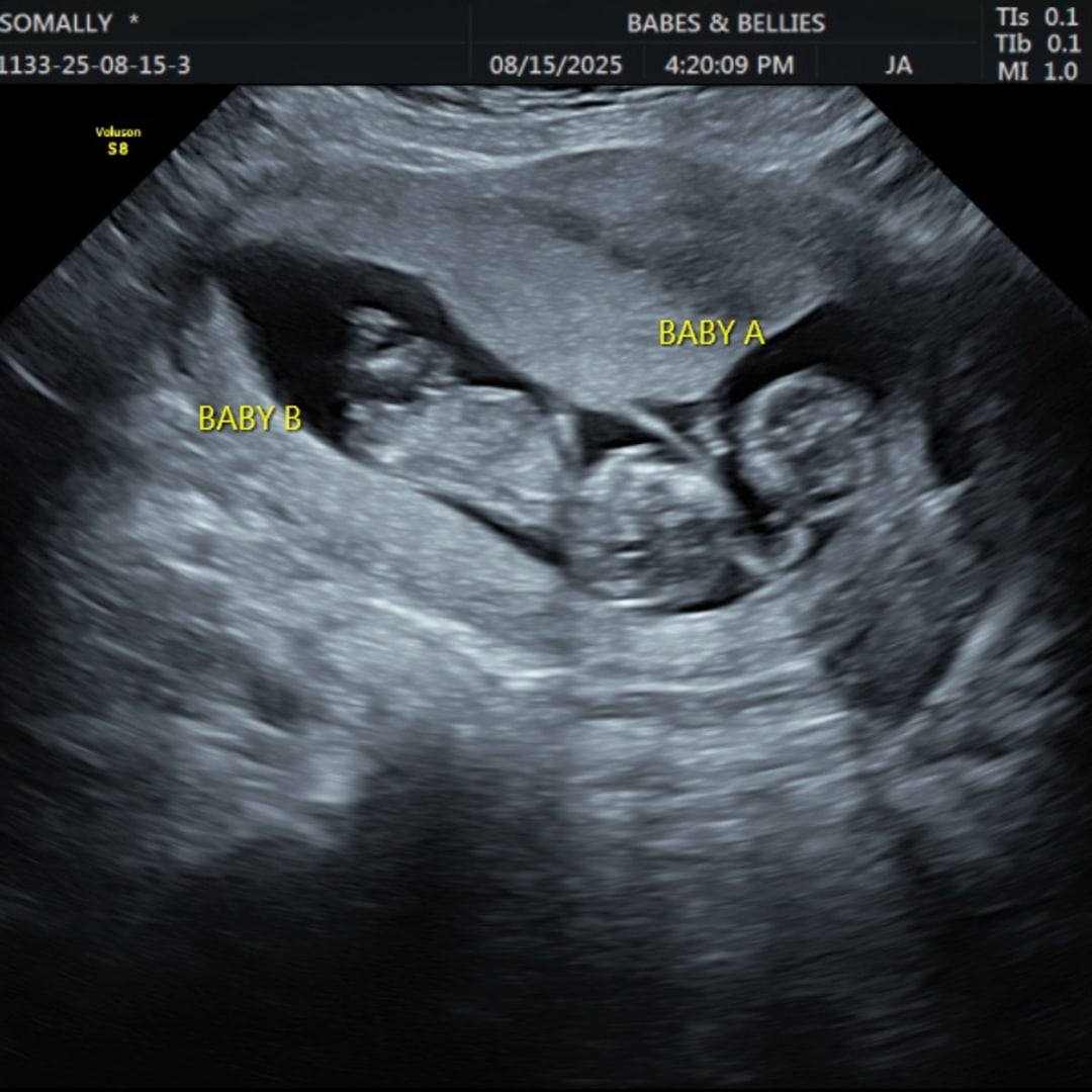 Photo shared by Molly for their Babylist baby registry.