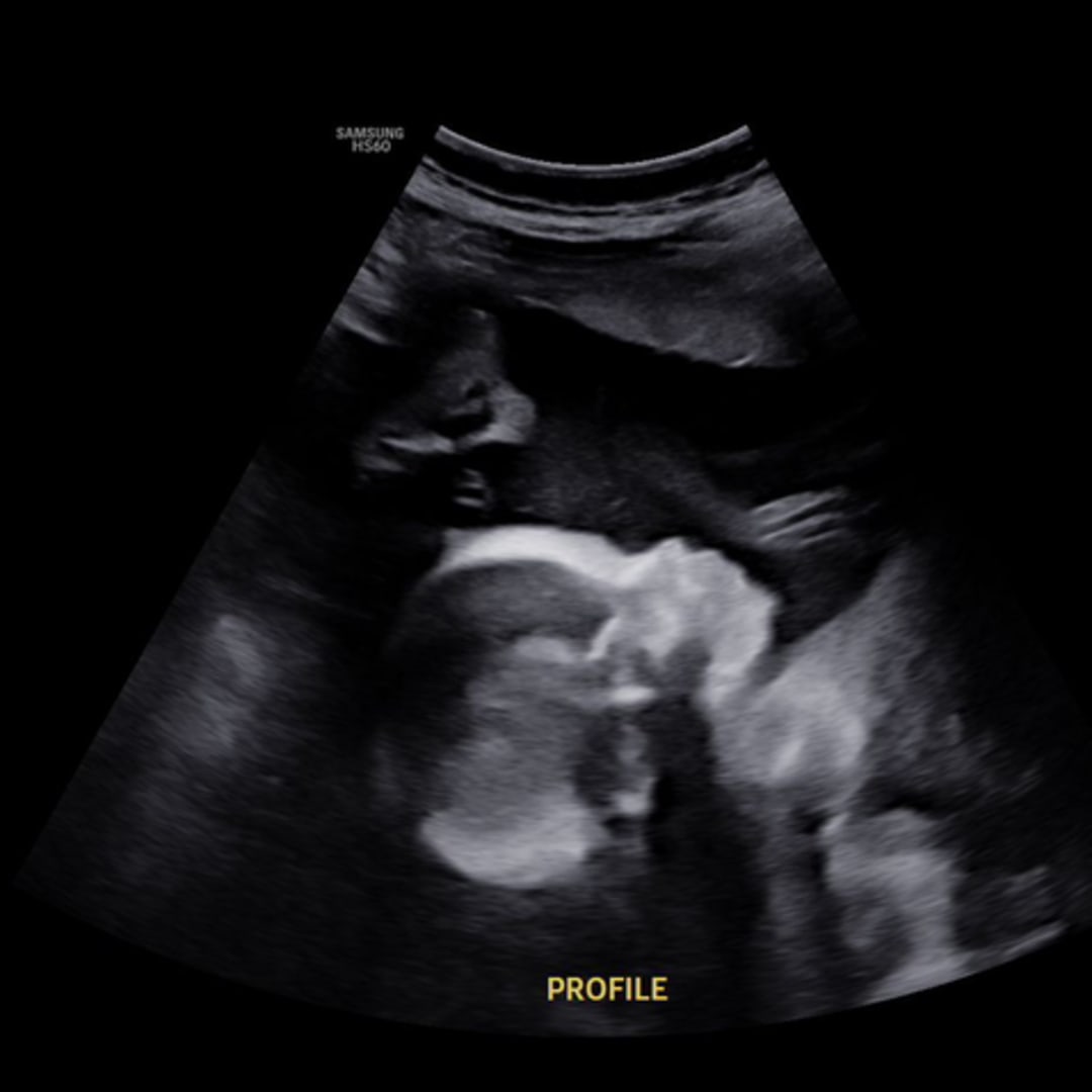 Photo shared by Rebecca for their Babylist baby registry.