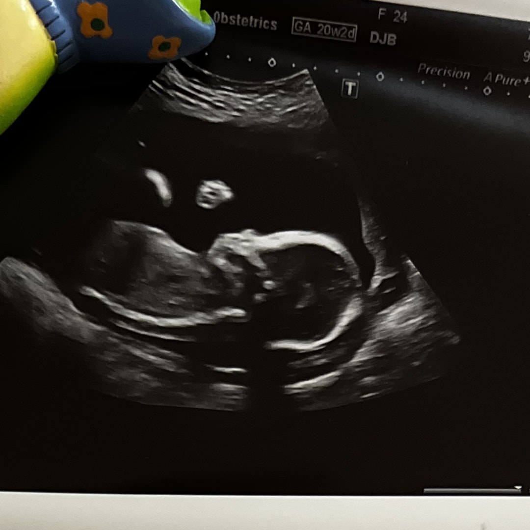 Photo shared by Haleigh for their Babylist baby registry.