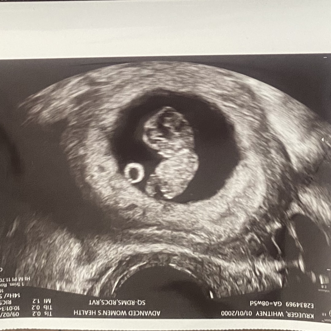 Photo shared by Whitney for their Babylist baby registry.