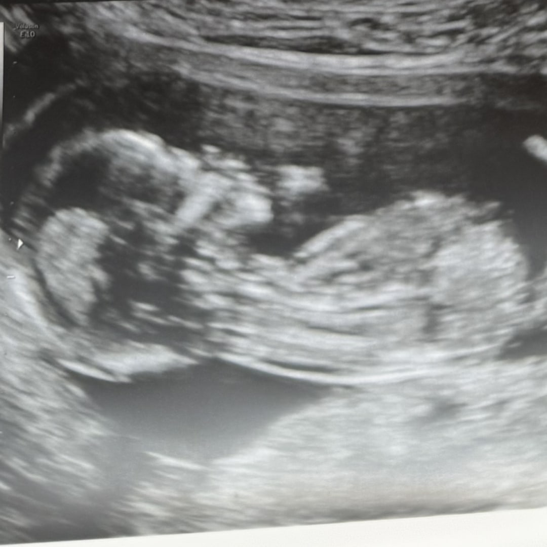 Photo shared by Natalia for their Babylist baby registry.
