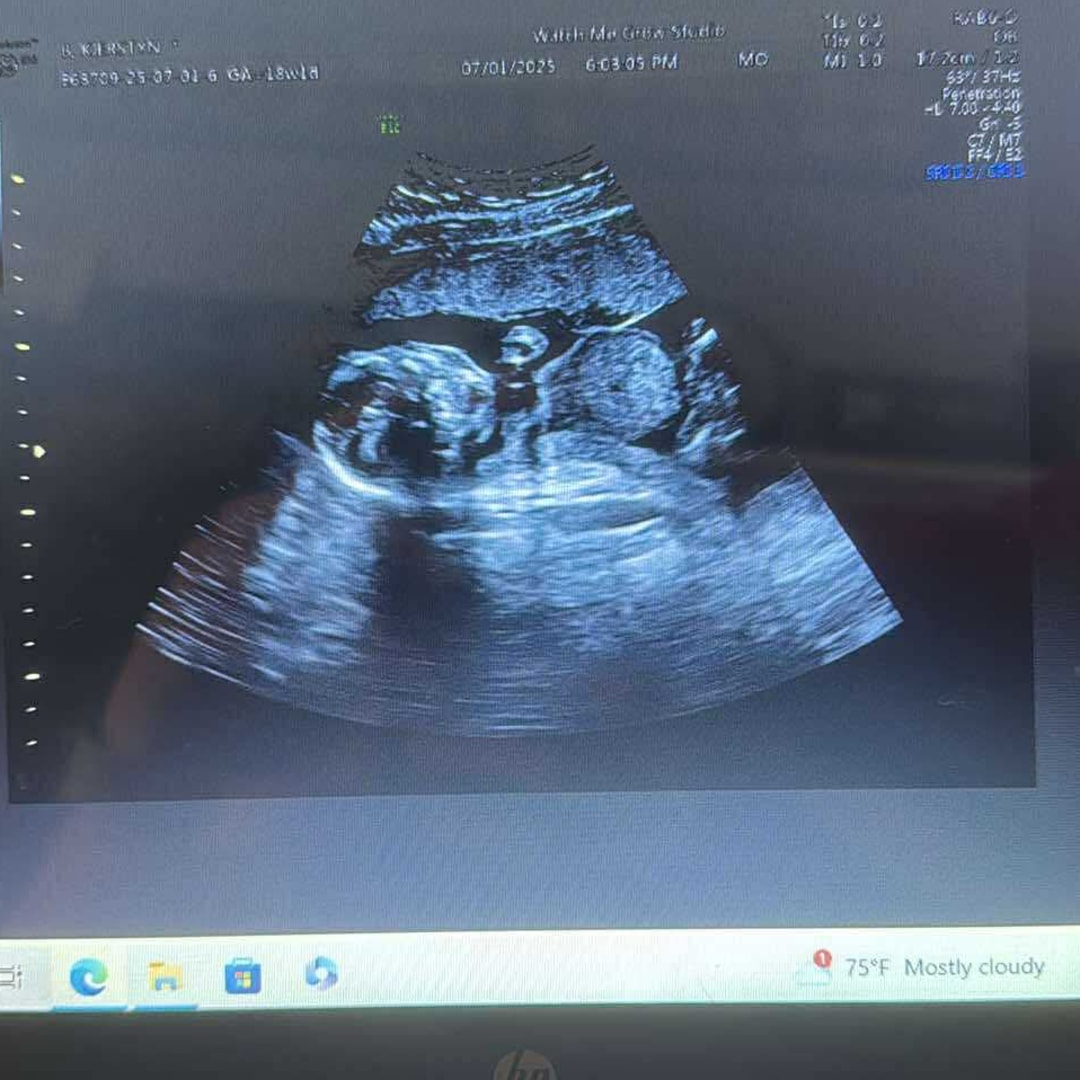 Photo shared by Kierstyn for their Babylist baby registry.