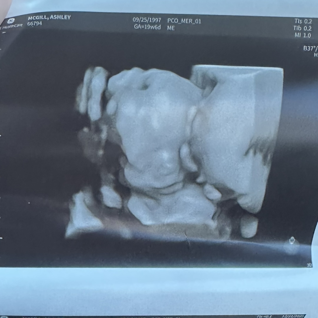 Photo shared by Ashley for their Babylist baby registry.