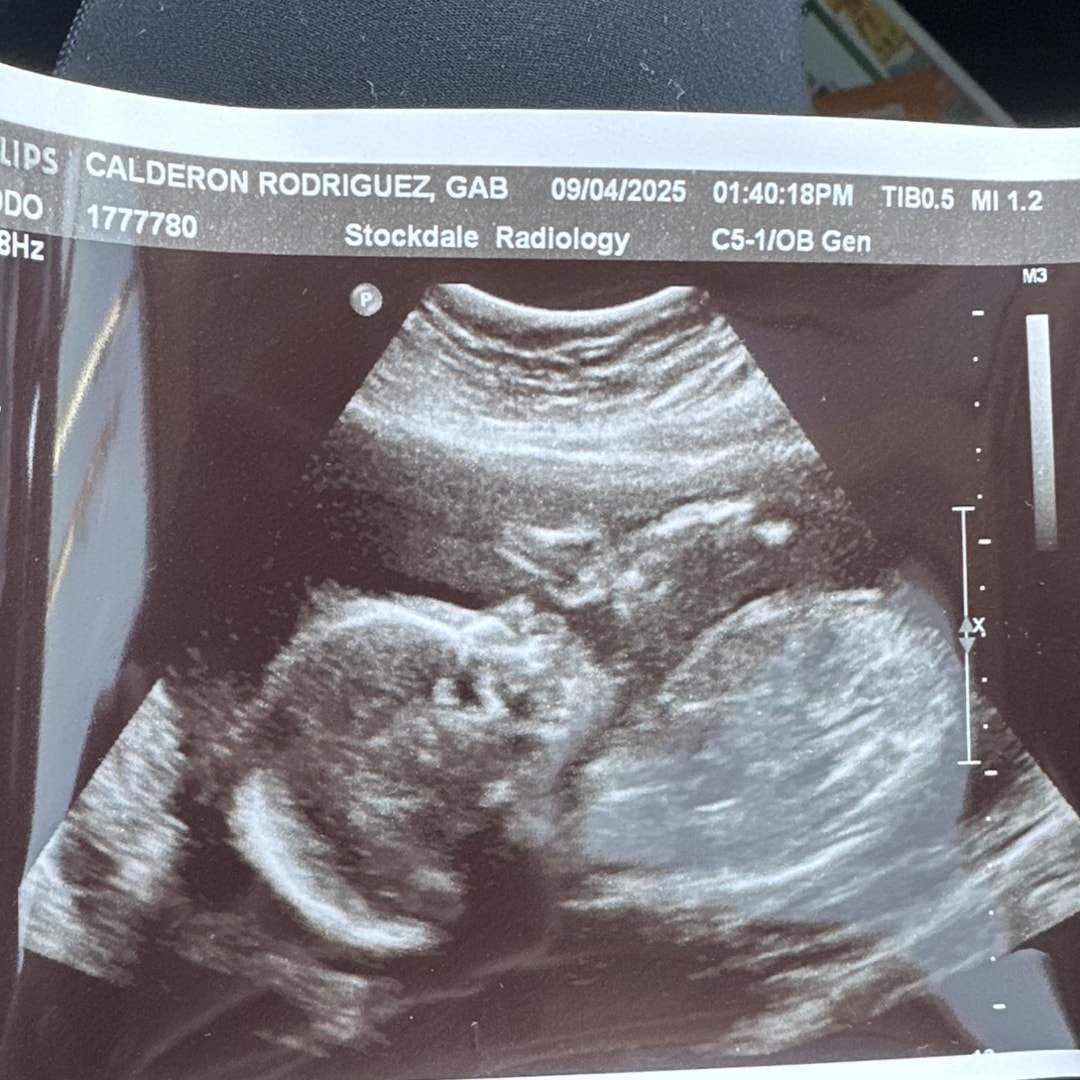 Photo shared by Gabriella for their Babylist baby registry.