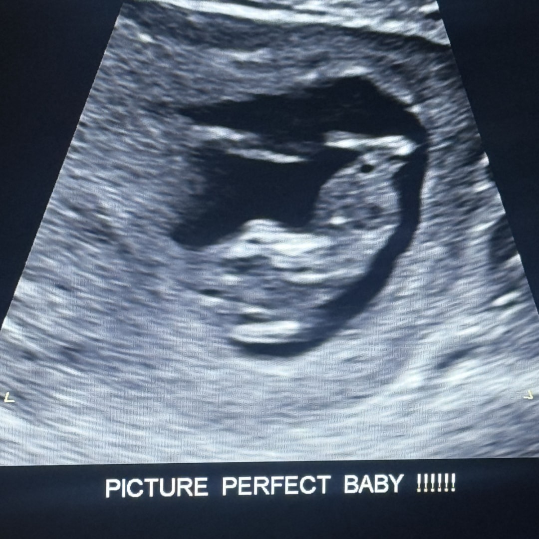 Photo shared by Luis for their Babylist baby registry.