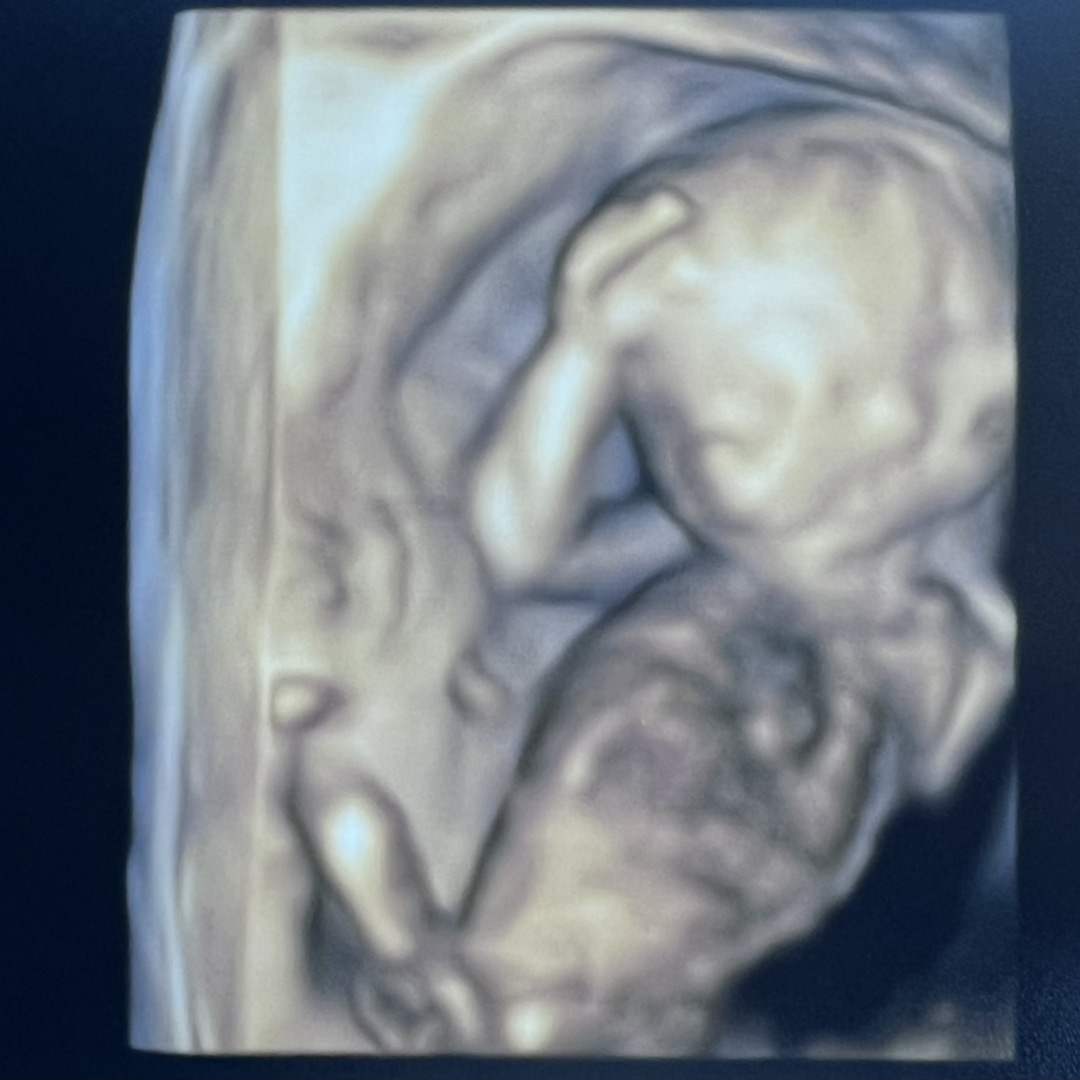 Photo shared by Miranda for their Babylist baby registry.