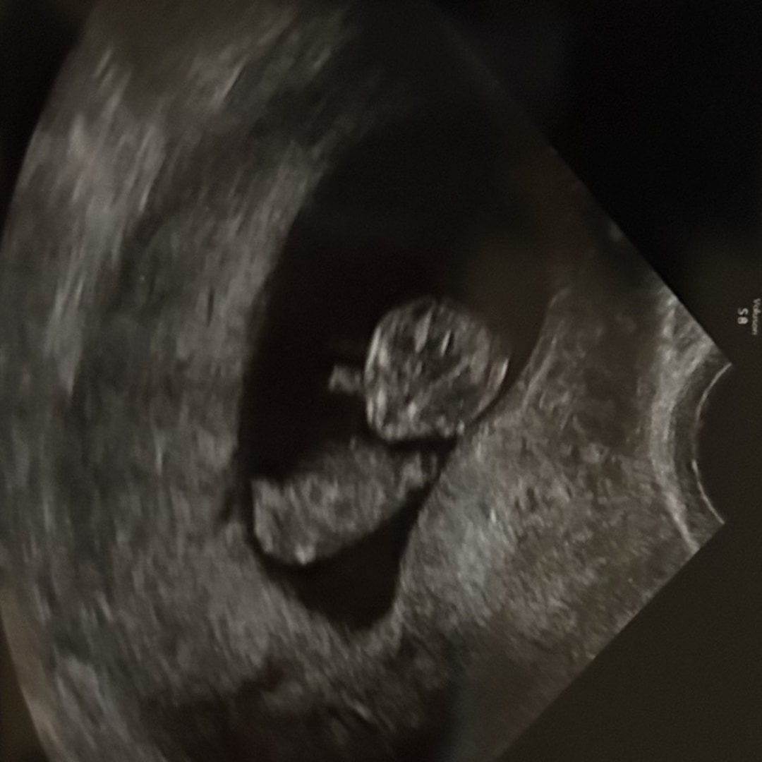 Photo shared by Athena for their Babylist baby registry.