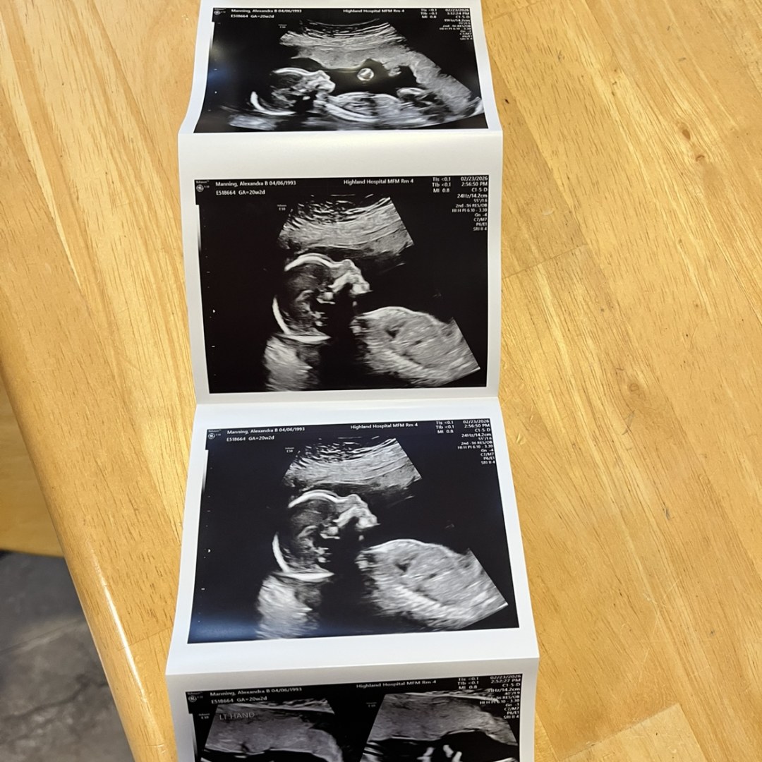 Photo shared by Alex for their Babylist baby registry.