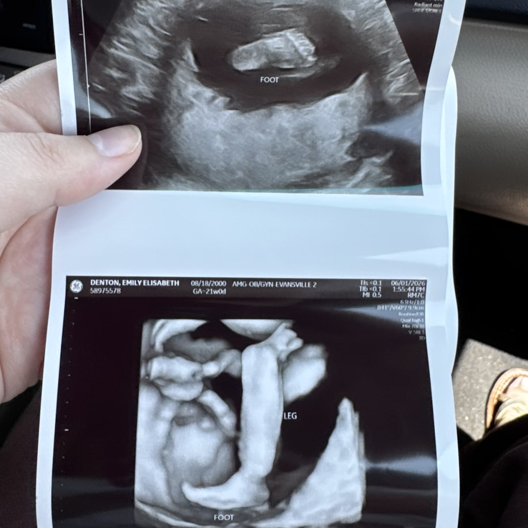 Photo shared by Emily for their Babylist baby registry.