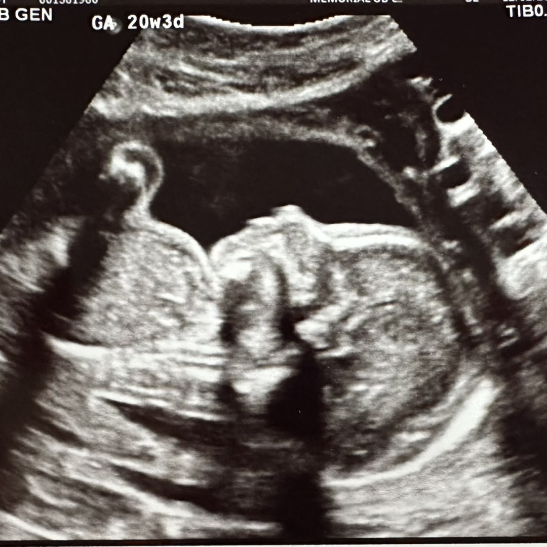 Photo shared by Leidy for their Babylist baby registry.