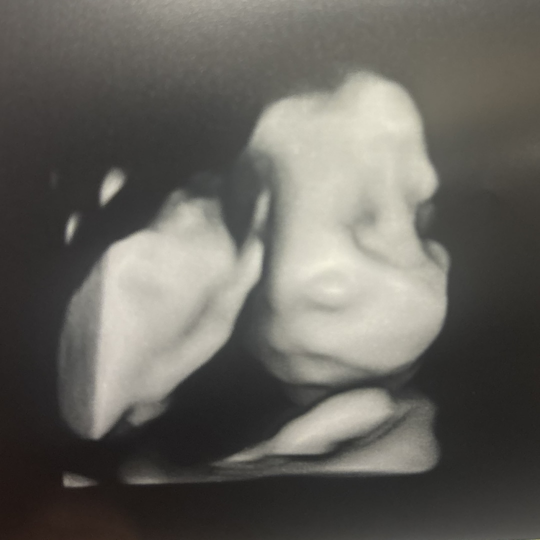 Photo shared by Daphne for their Babylist baby registry.