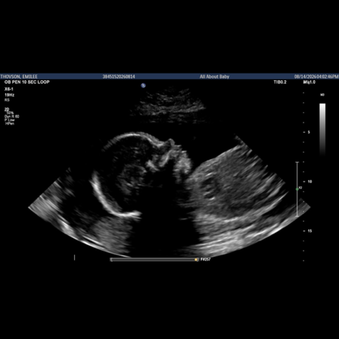 Photo shared by Emilee for their Babylist baby registry.