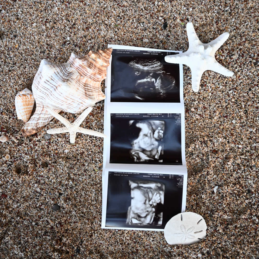 Photo shared by Megan for their Babylist baby registry.