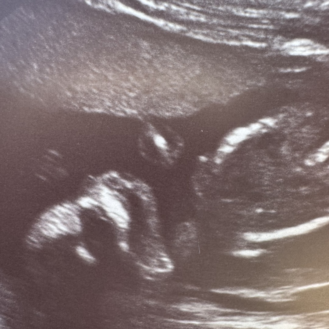 Photo shared by Aubrey for their Babylist baby registry.