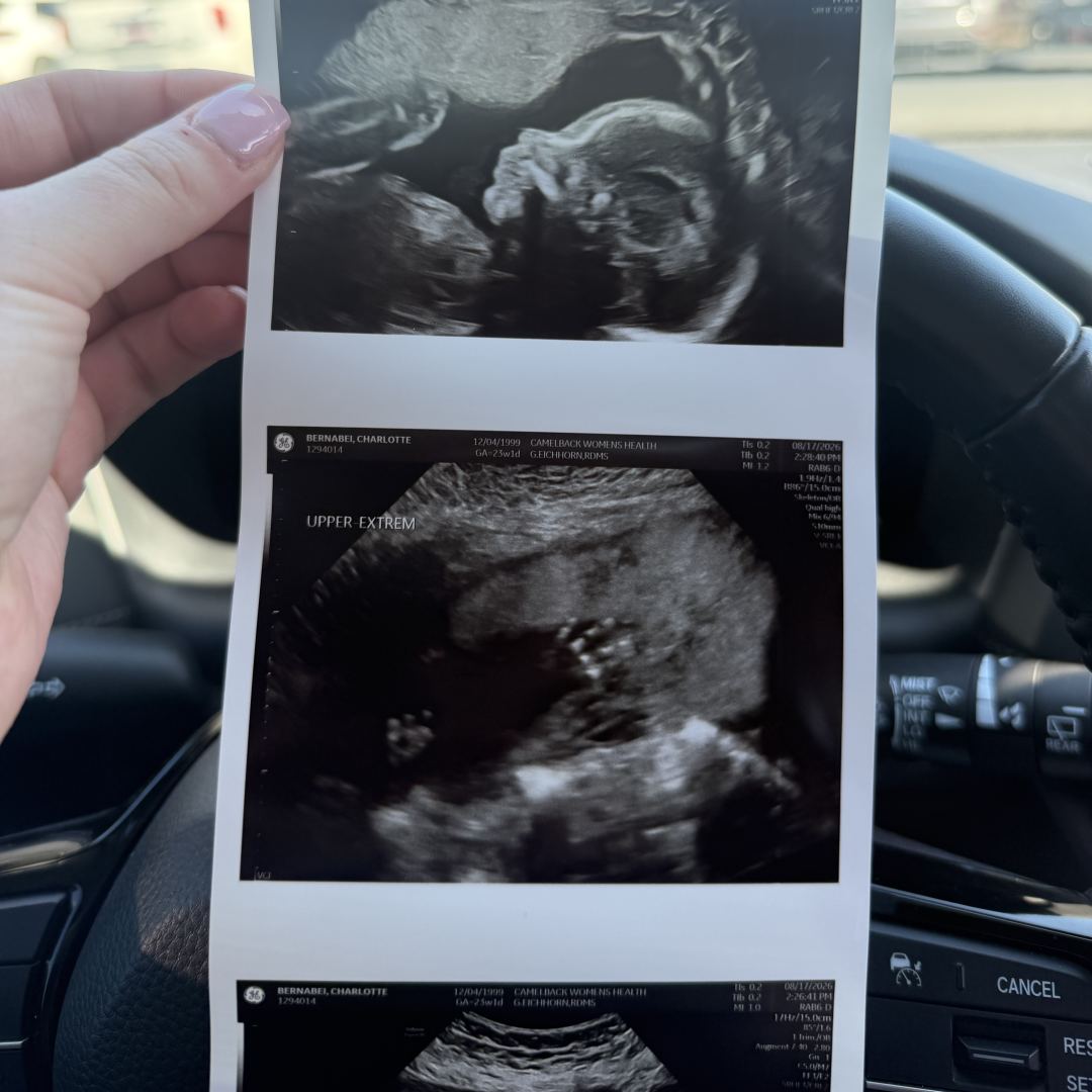 Photo shared by Grace for their Babylist baby registry.