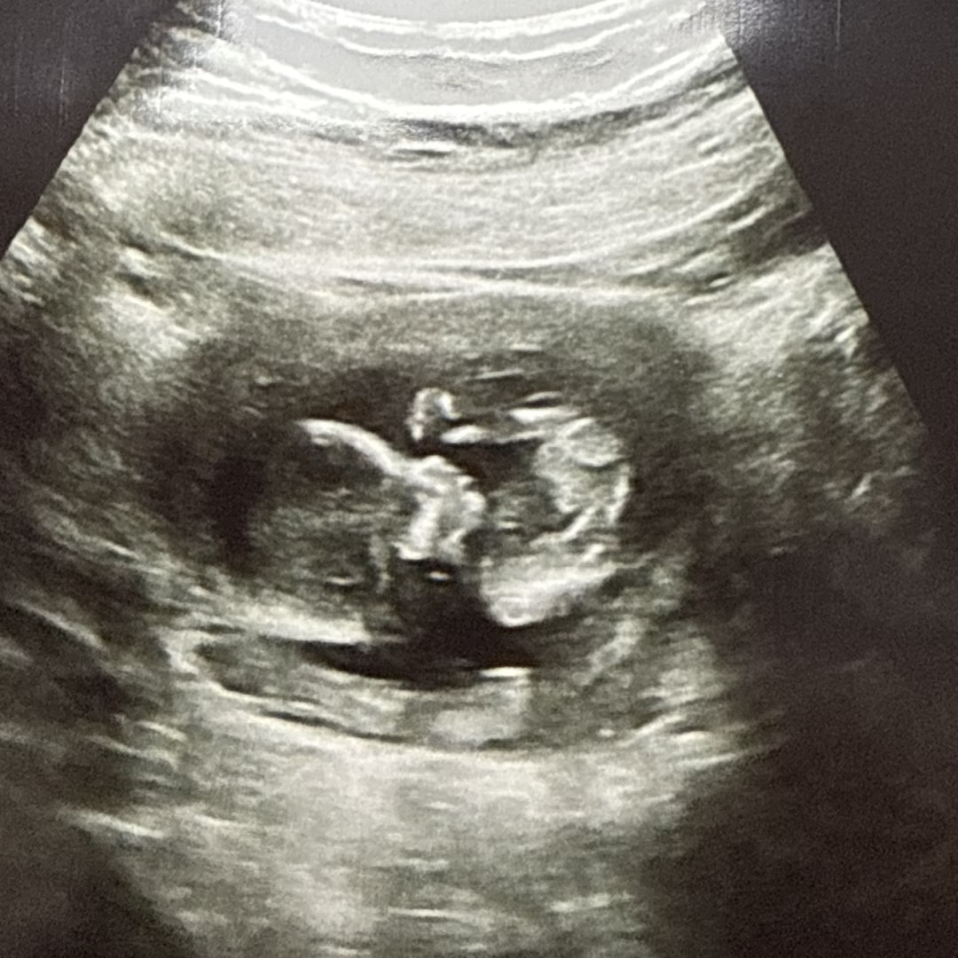 Photo shared by Anabelle for their Babylist baby registry.