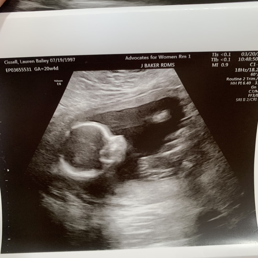 Photo shared by Baylee for their Babylist baby registry.