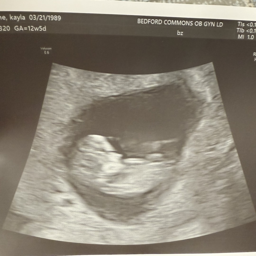 Photo shared by Kayla for their Babylist baby registry.