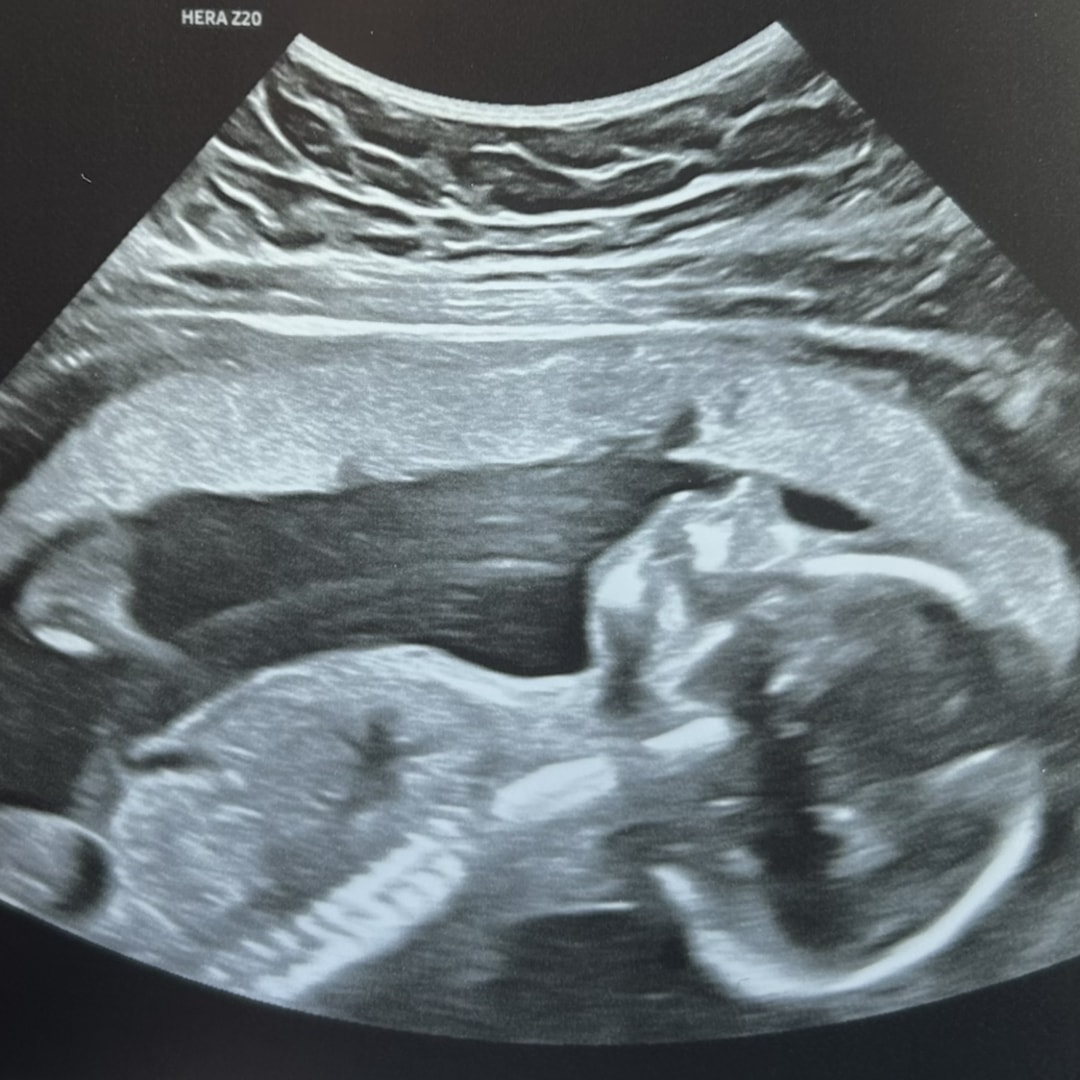 Photo shared by Samantha for their Babylist baby registry.