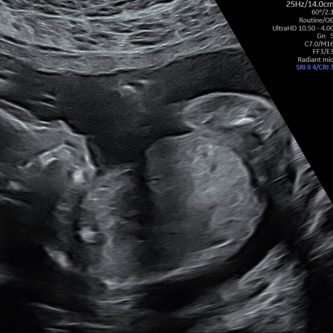 Photo shared by Rayanna for their Babylist baby registry.