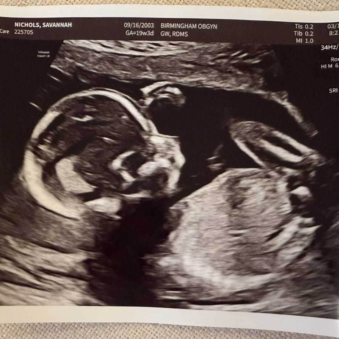 Photo shared by Savannah for their Babylist baby registry.