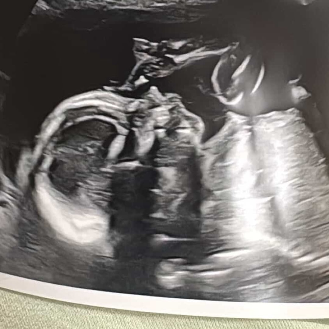 Photo shared by Branka for their Babylist baby registry.