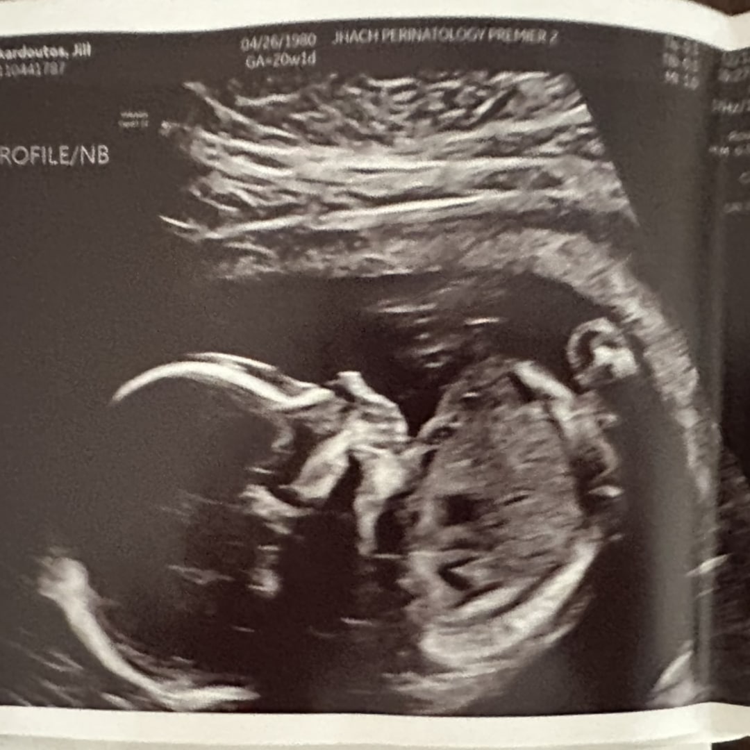 Photo shared by Jill for their Babylist baby registry.