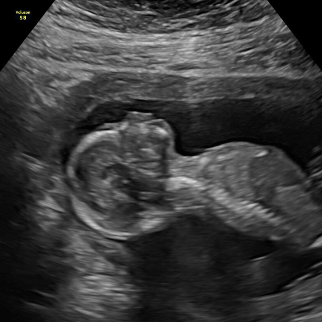 Photo shared by Jade for their Babylist baby registry.