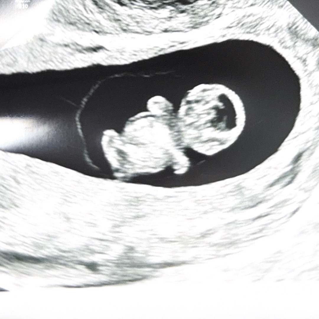 Photo shared by Carol for their Babylist baby registry.