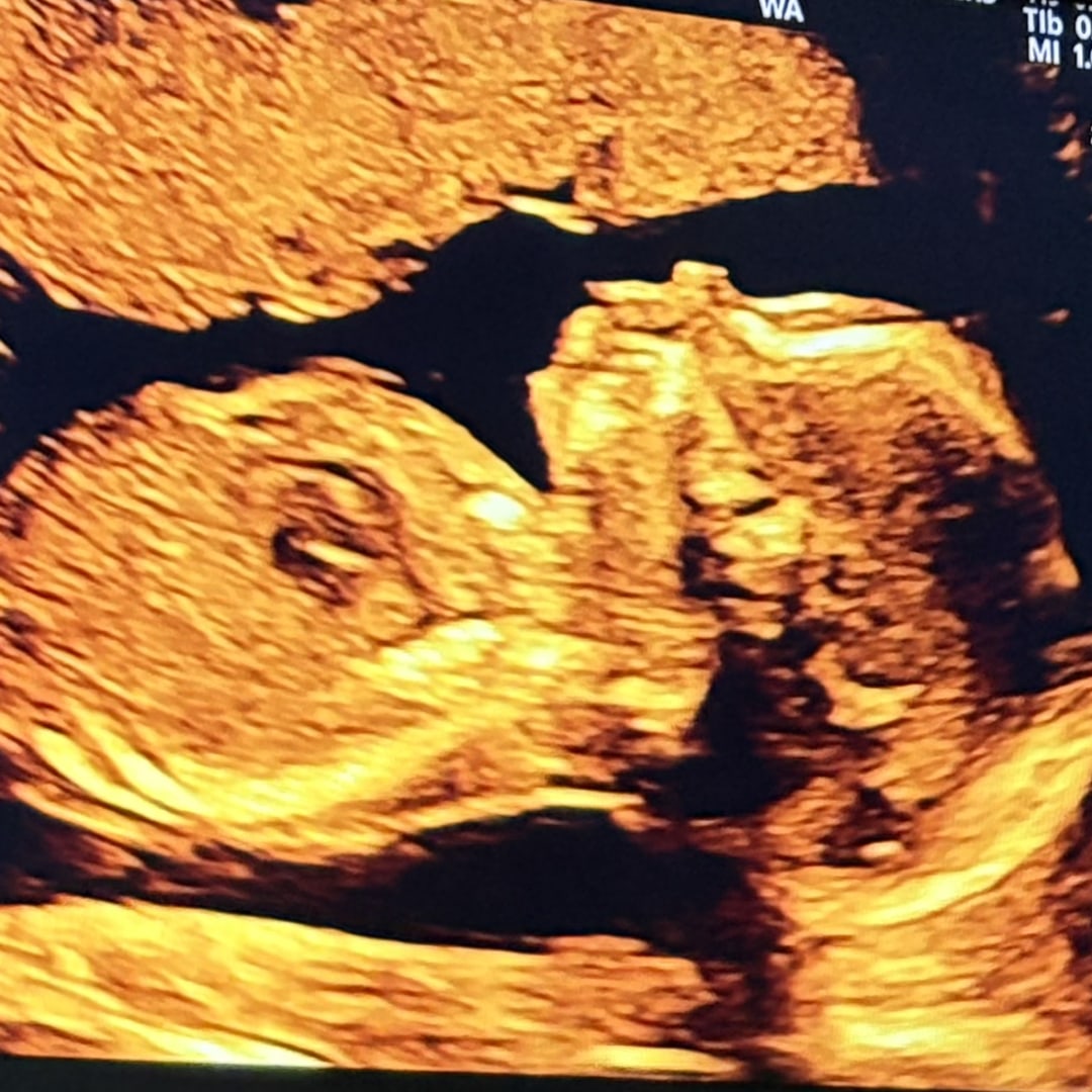 Photo shared by Alexis for their Babylist baby registry.