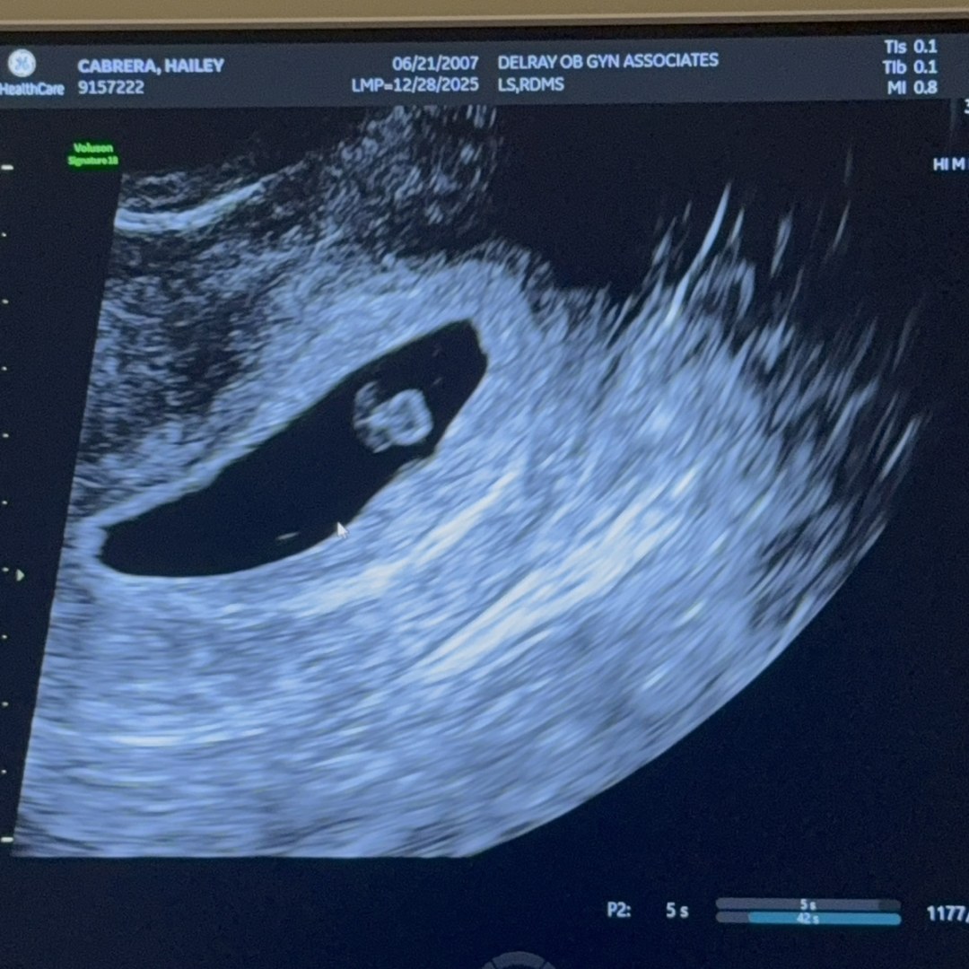 Photo shared by Hailey for their Babylist baby registry.