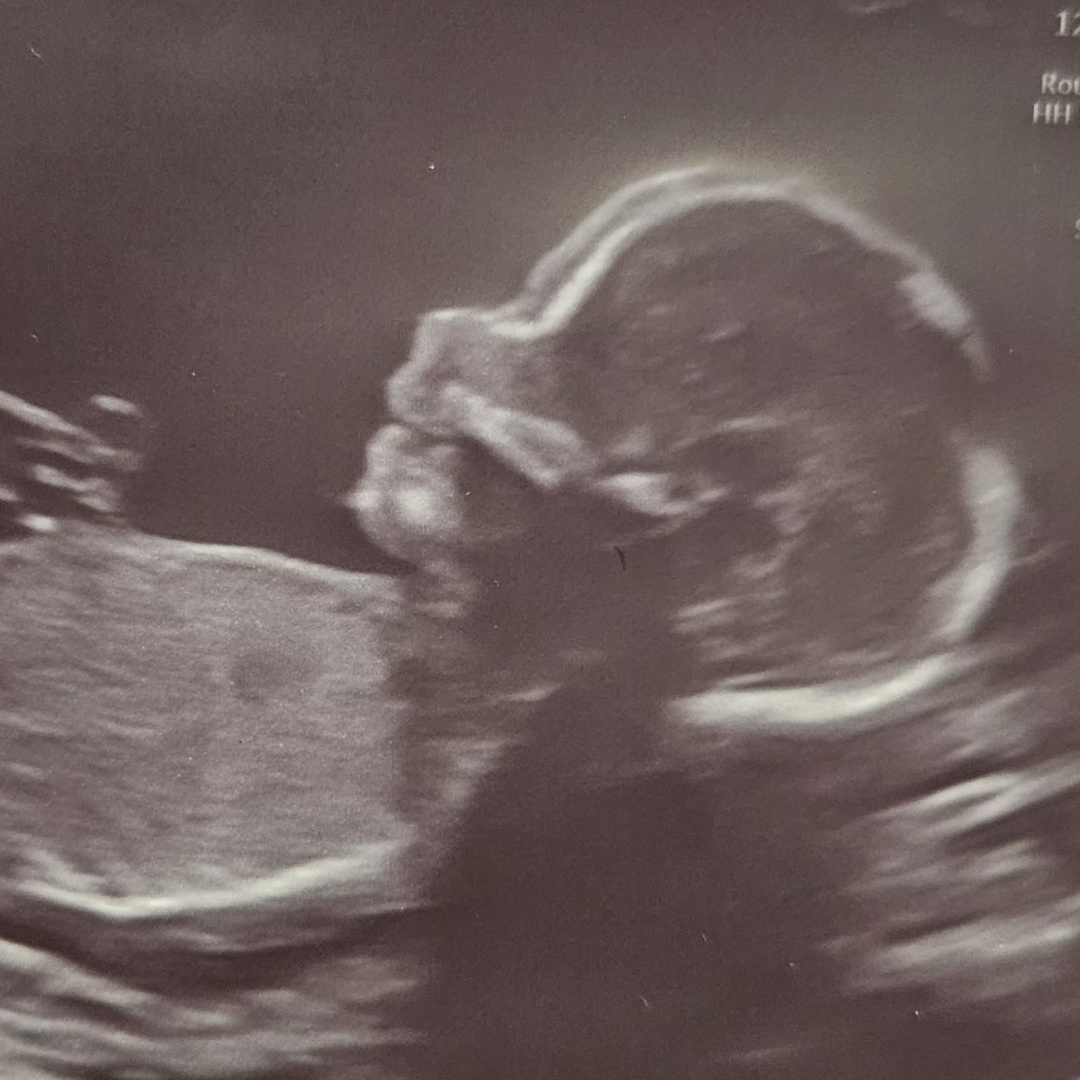 Photo shared by Haley for their Babylist baby registry.