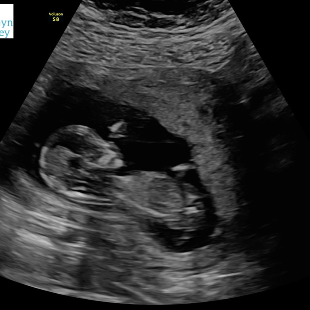 Photo shared by Carlie for their Babylist baby registry.